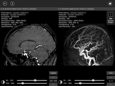 デュアル画面機能