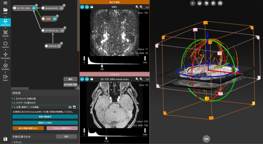 強力なレジストレーション機能