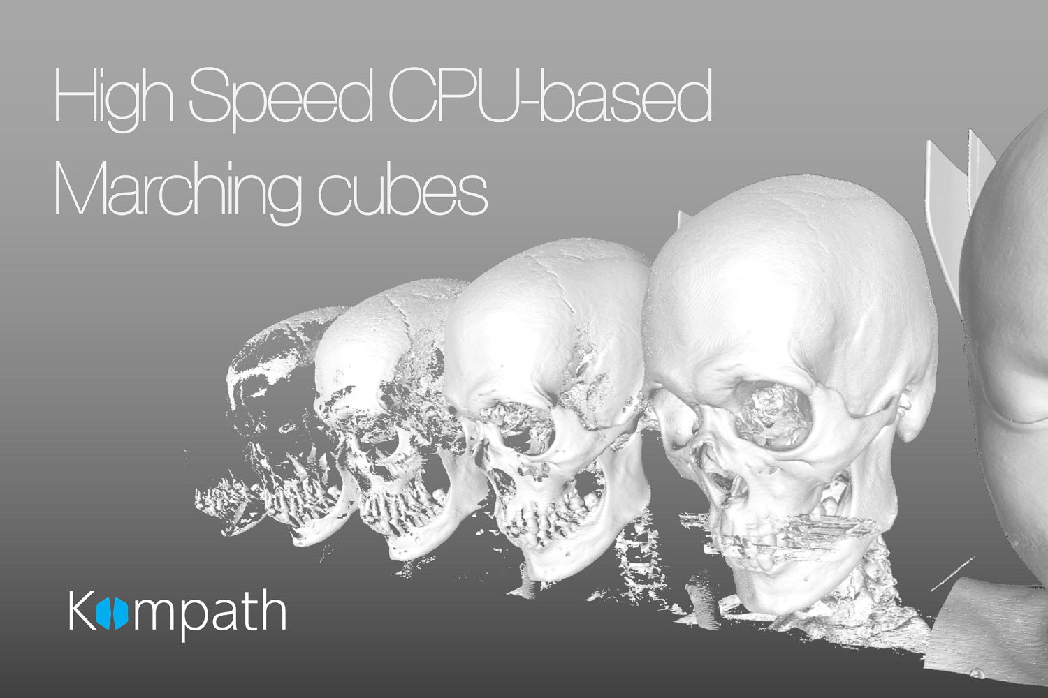 DICOMビューワー: eMma