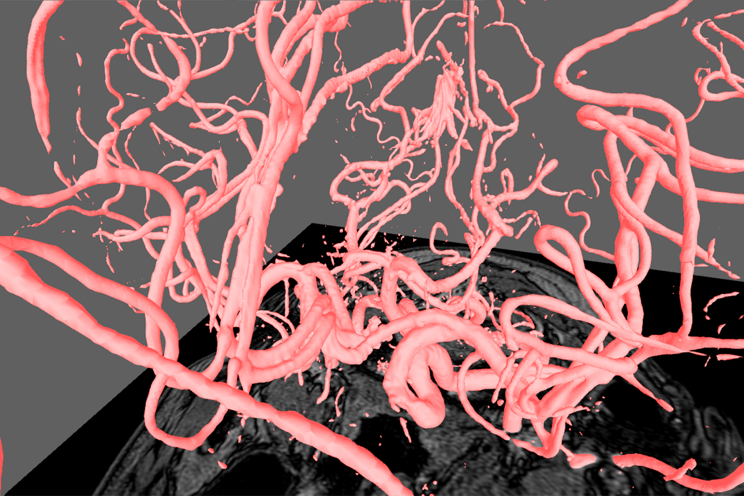 デュアル画面機能